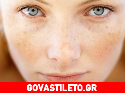 Διώξτε τις πανάδες με σταφίδα, λεμόνι και πορτοκάλι!